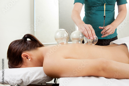 Cuppping Acupuncture Treatment on Female Back photo