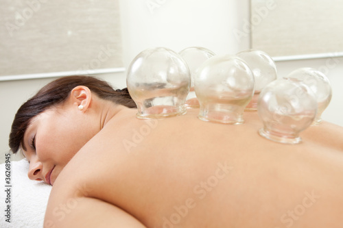 Acupuncture Cupping Treatment photo