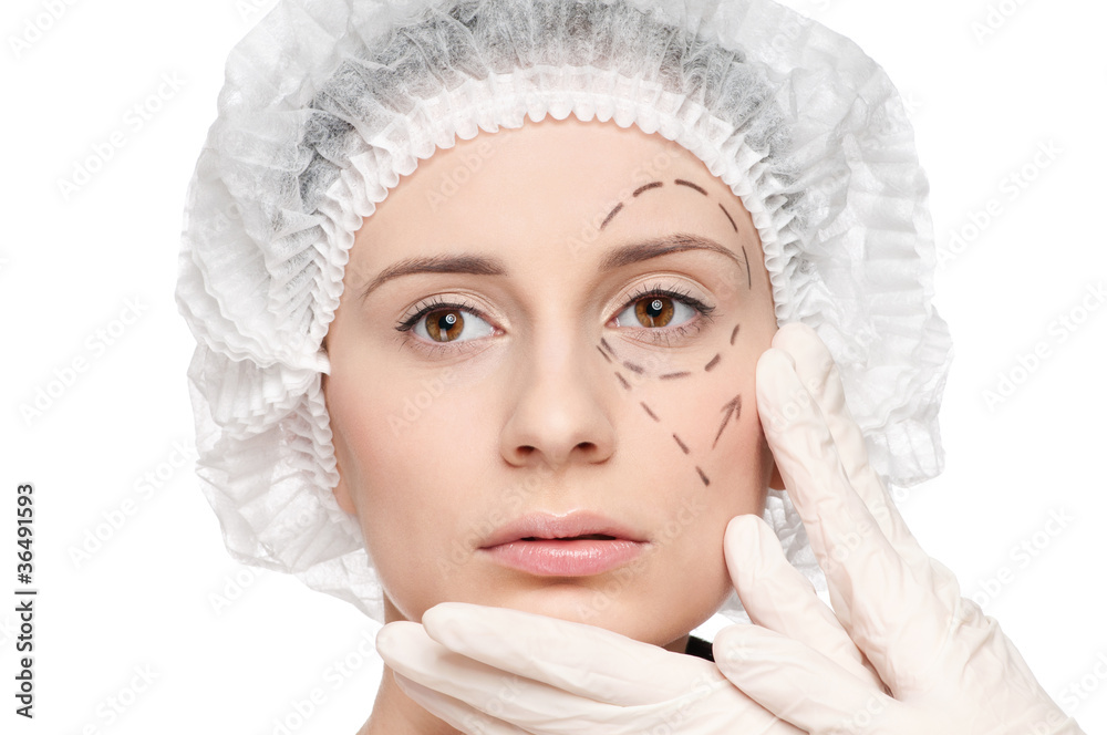Correction lines on woman face, before surgery operetion Correction lines on woman face, before surgery operetion