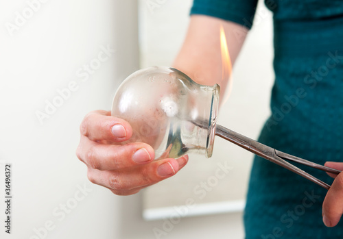 Acupuncture Cupping Bulb Detail photo