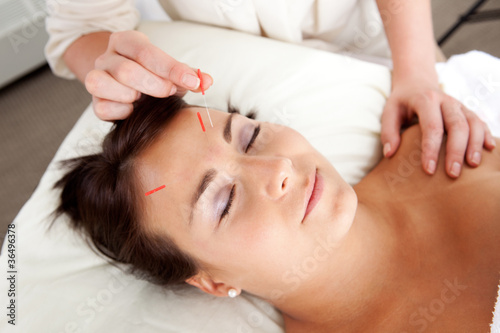 Facial Acupuncture Treatment Needle Stimulation