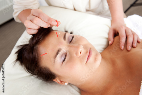 Obraz na plátně Facial Acupuncture Treatment Needle Stimulation