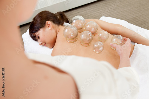 Woman Receiving Cupping Treatment photo
