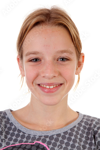 Portait of teenage girl with pimpels photo