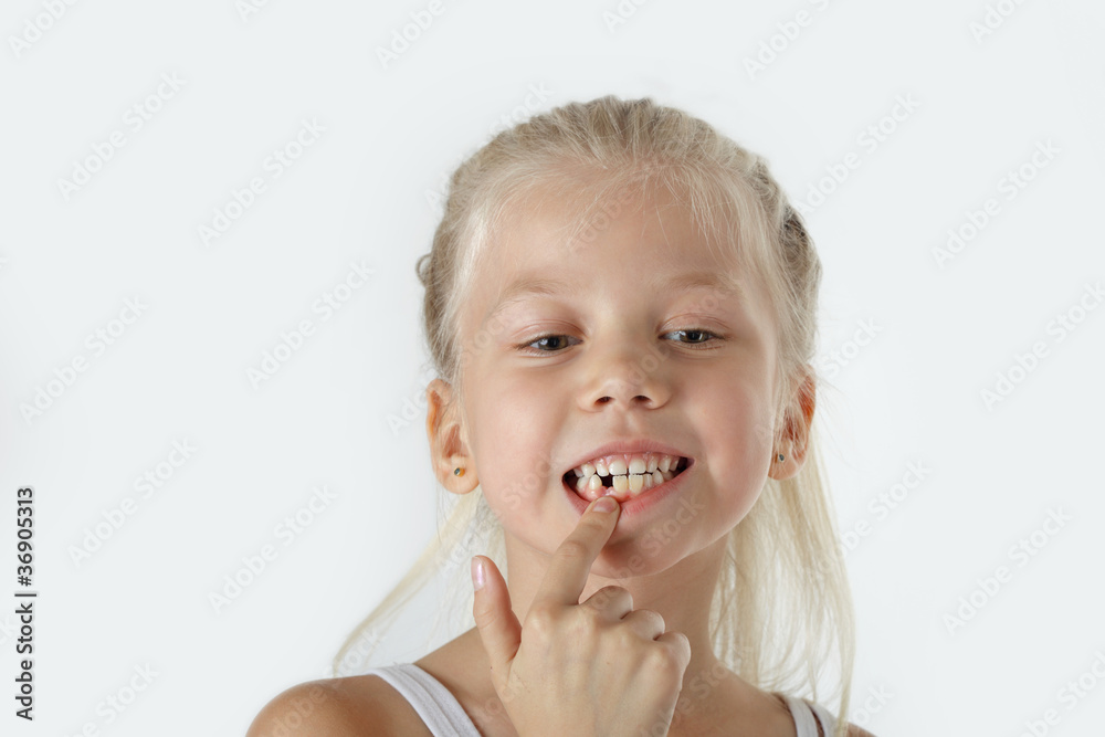 Little girl with missing front teeth Little girl with missing front teeth