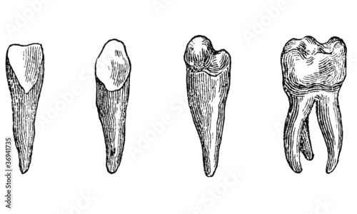 Dents