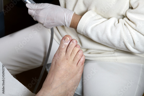 Medizinische Fu  pflege - Foot care - Chiropody