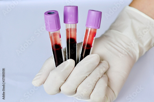 Quadro em tela Blood sample
