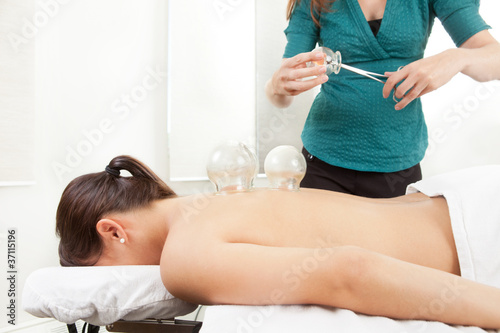Cupping Acupuncture Treatment photo