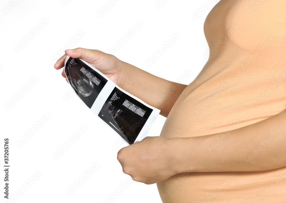 Pregnant woman is watching on ultrasound Pregnant woman is watching on ultrasound