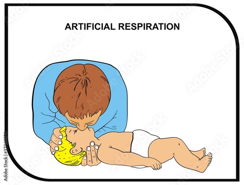 VECTOR - Artificial Respiration (Baby)