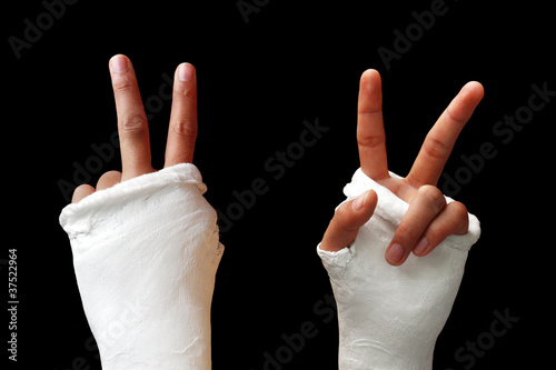 My Splint01