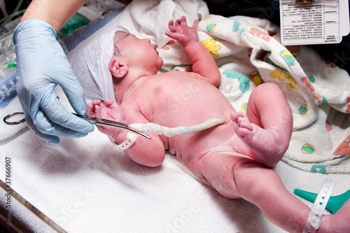 Newborn cute infant baby with umbilical cord photo