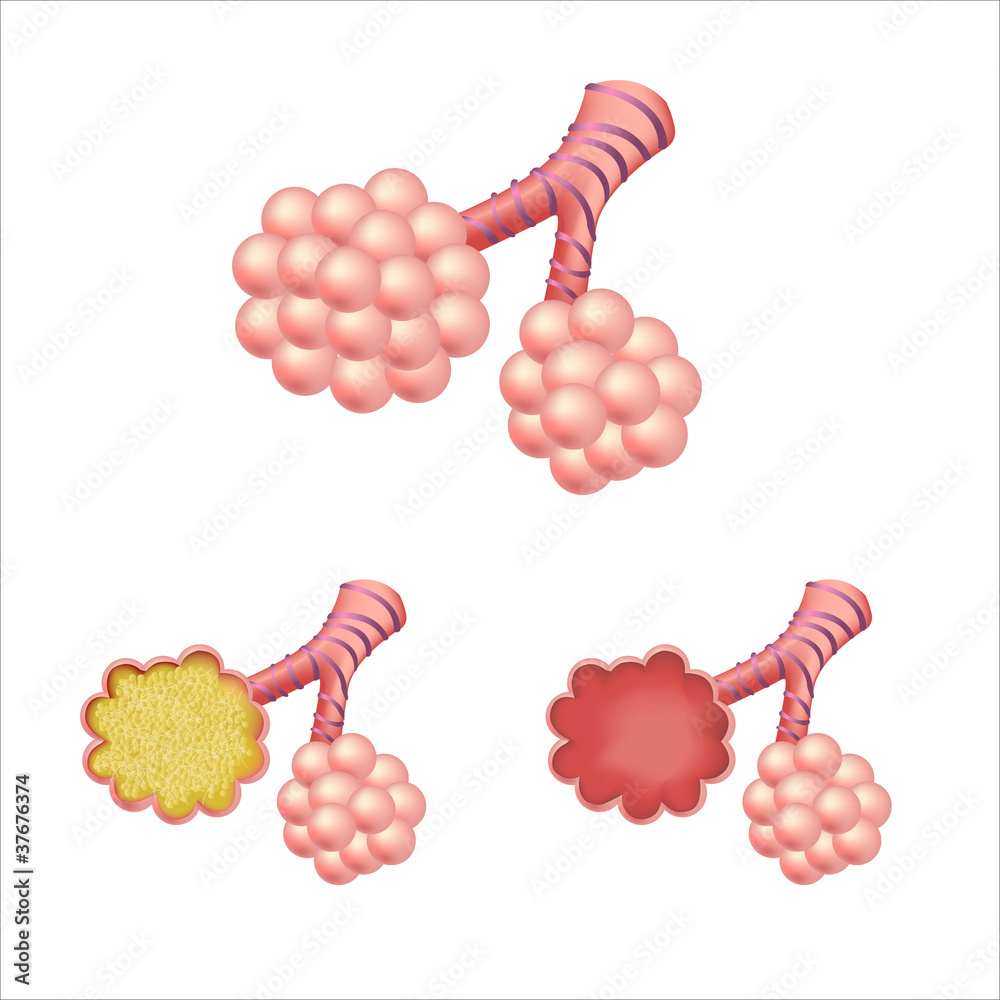 Obraz premium Alveoli In Set