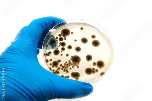 microbiological plate with fungi