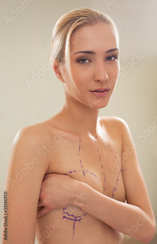 Obraz na płótnie Woman with correction lines on breasts