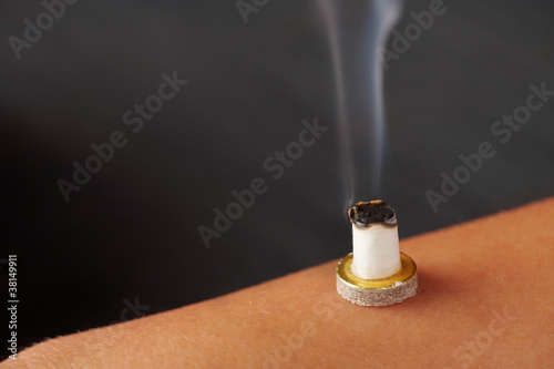 Smokig mini moxa stick