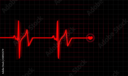 Heartbeat