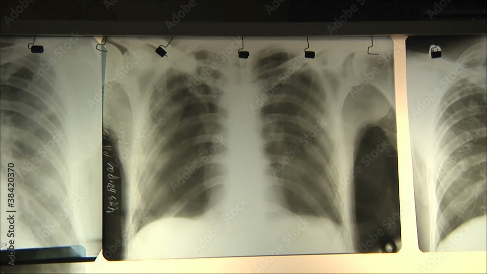 doctors regard chest x-ray 2