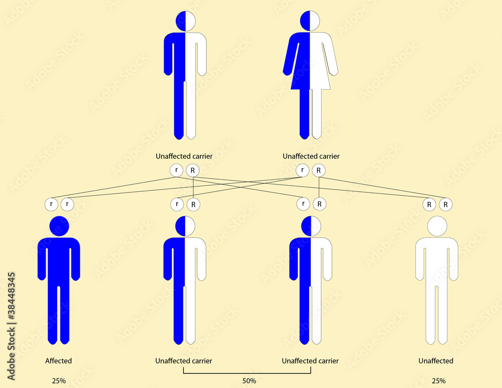 Thalassemia pattern of inheritance Stock Illustration | Adobe Stock