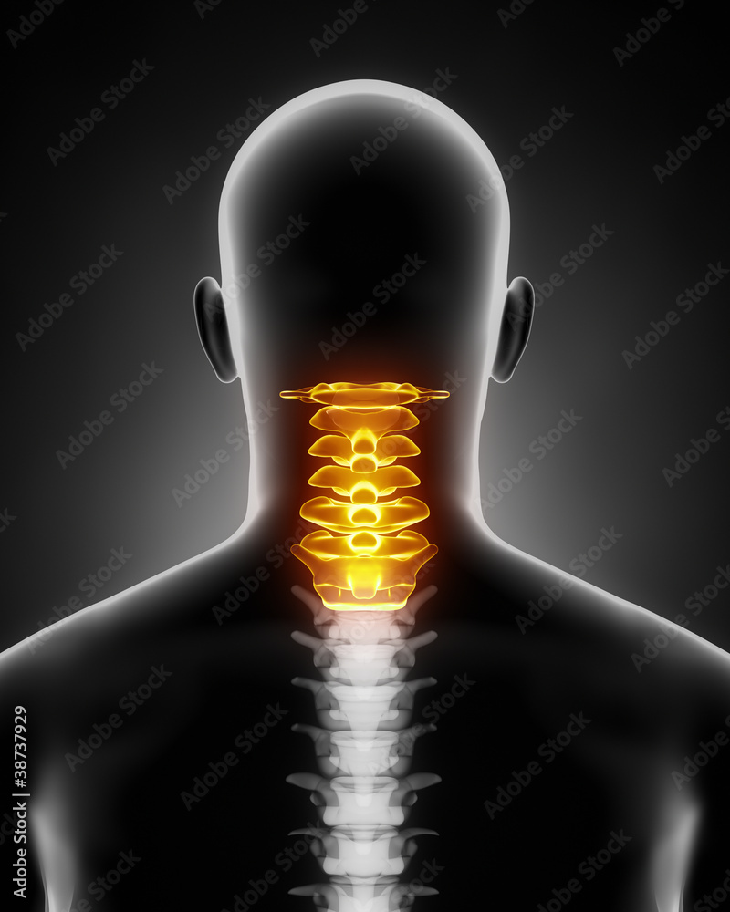 vertebrele cervicale mobile unguente pentru dureri de spate și articulații