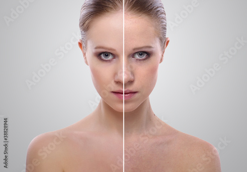 effect of healing of skin, beauty young woman before and after t