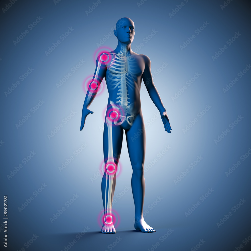 Silhouette des Mannes mit Gelenkschmerzen und Skelett
