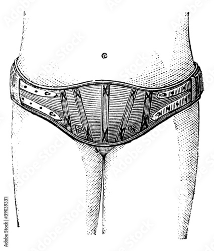 Hypogastric belt, vintage engraving. photo