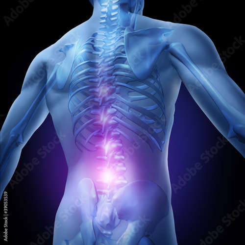 Tableau sur toile Lower Back Pain