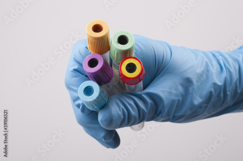 blood tubes in the hand of a nurse photo