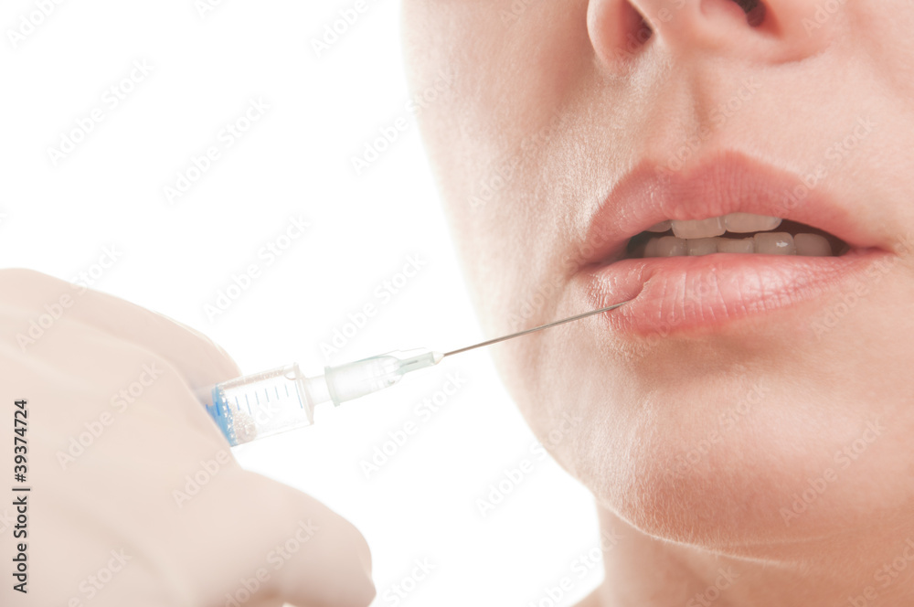 Woman with marks drawn on face during botox procedure Woman with marks drawn on face during botox procedure