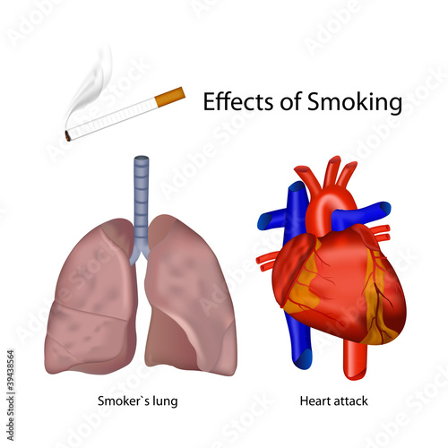 smoking effects of the human body vector illustration