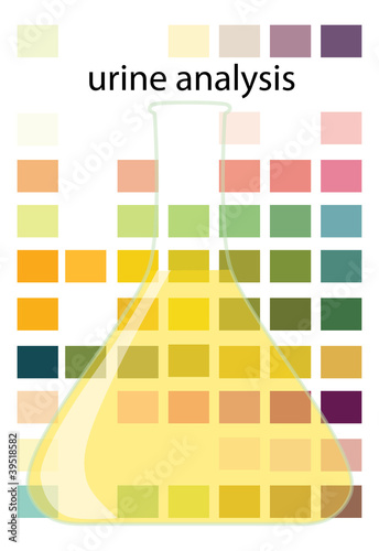 urine analysis