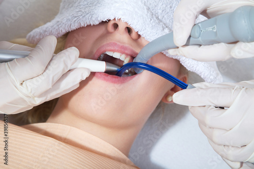 Vorreinigung zur kosmetischen Zahnaufhellung Absaugeschlausch Nahaufnahme