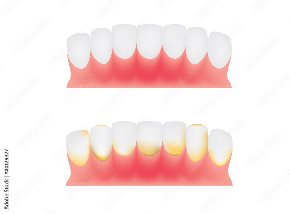 Obraz premium teeth and gums
