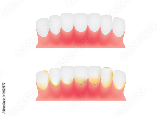 teeth and gums