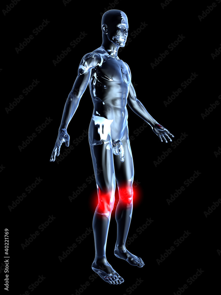 Knieschmerzen - Anatomie Knieschmerzen - Anatomie