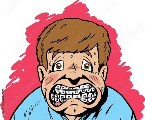 Braces