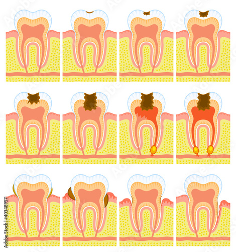Internal structure of tooth