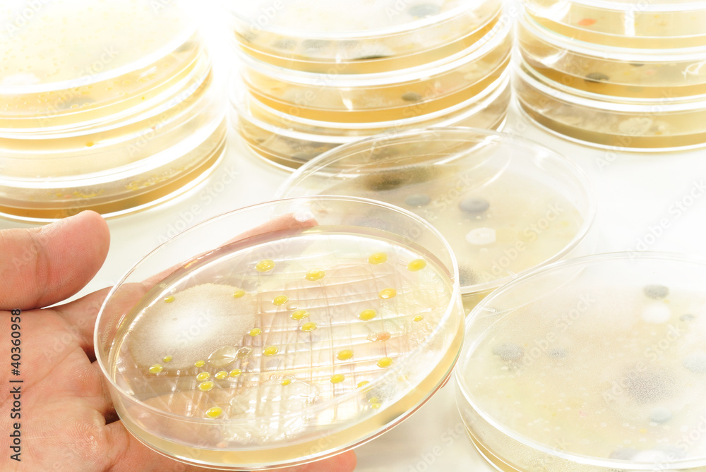 Macro mold and bacterai colonies growing on an agar plates. Macro mold and bacterai colonies growing on an agar plates.