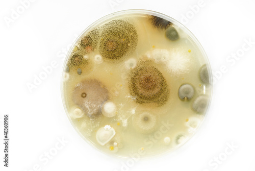 Macro mold and bacterai colonies growing on an agar plates.