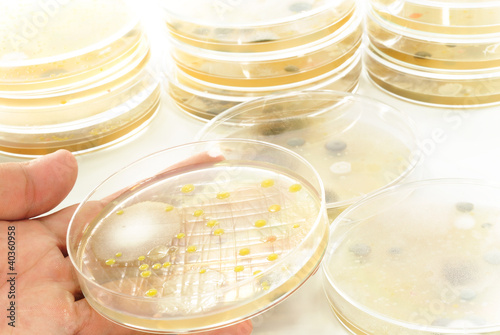 Macro mold and bacterai colonies growing on an agar plates.