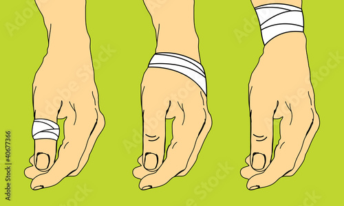 First aid for sprains.