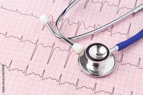 ECG printout and stethoscope