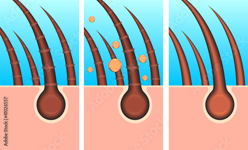 skin hair layer illustration vector