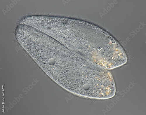 Quadro su tela Paramecium caudatum - Pantoffeltierchen - Konjugation
