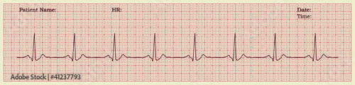 cardiogram