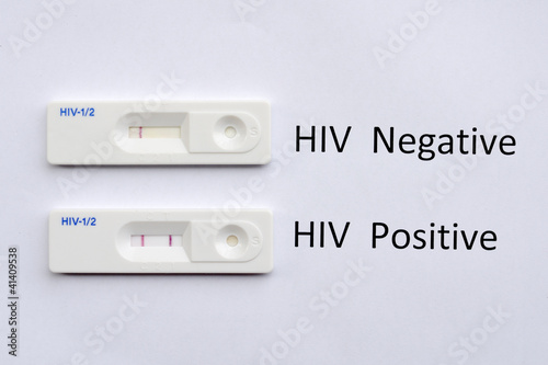 Фотография HIV testing