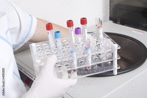 Hands loads blood samples in centrifuge