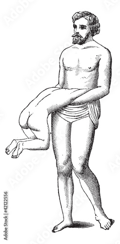 Fig. 600. Twin reversed arterial perfusion, vintage engraving.